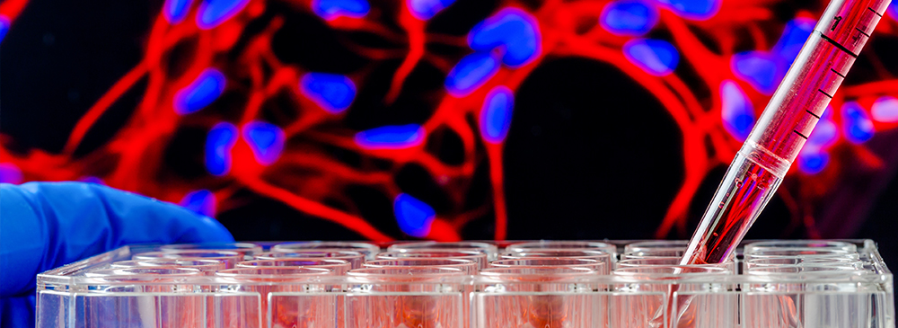 Tissue engineering & Regenerative medicine